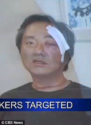 Keith Cho after gang attack (courtesy CBS News)